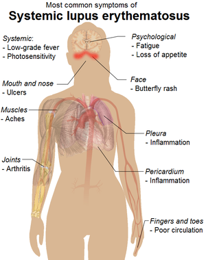 English: Common signs and symptoms of systemic...